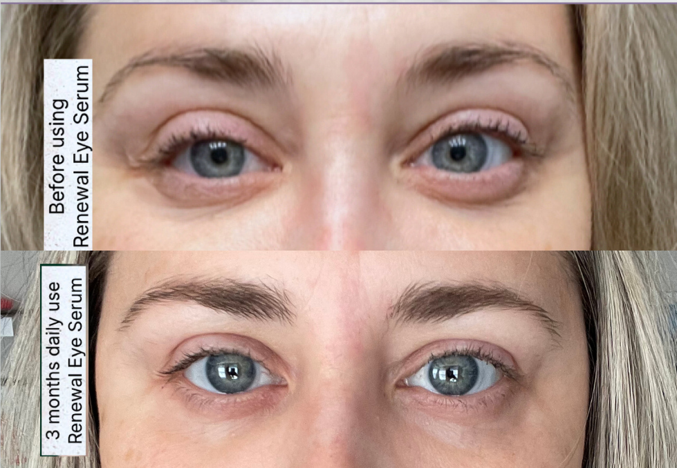 Renewal Eye Serum
